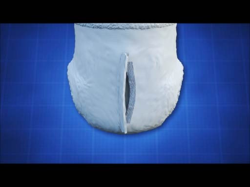Incontinence Male Underwear with Closable Opening